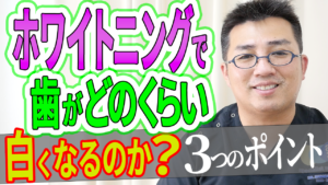 ホワイトニングで実際歯がどのくらい白くなるのか