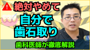 歯石は自分で取れるもの？
