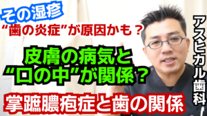 【掌蹠膿疱症と歯科】口の中の病気と全身のつながり｜アスヒカル歯科 加藤院長が解説
