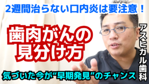 【要注意】歯肉がんの見分け方｜もしかしてその口内炎、がんかも？歯科医が解説