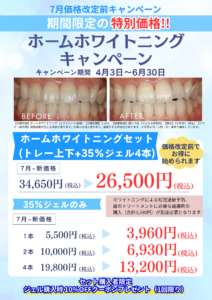 【4/3〜6/30限定】7月の価格改定前に！ホームホワイトニングキャンペーンのお知らせ