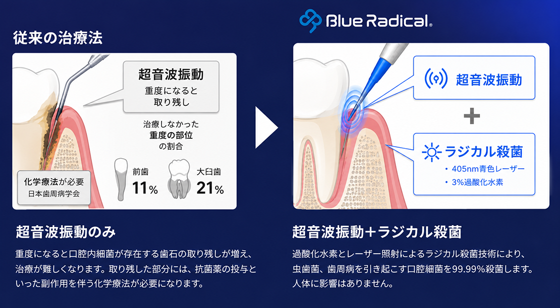 ブルーラジカル治療とは｜厚生労働省承認の医療機器
