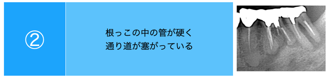 石灰化画像