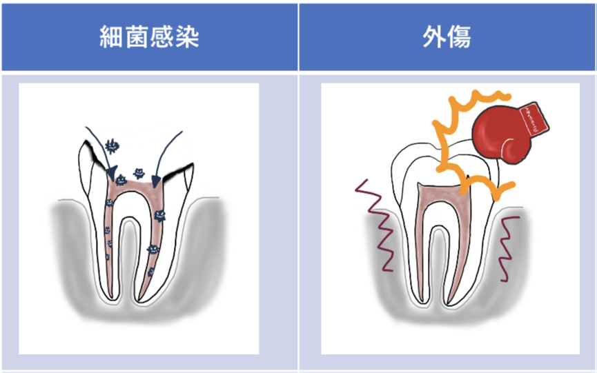 神経腐る表