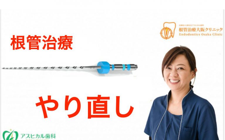 根管治療やり直し