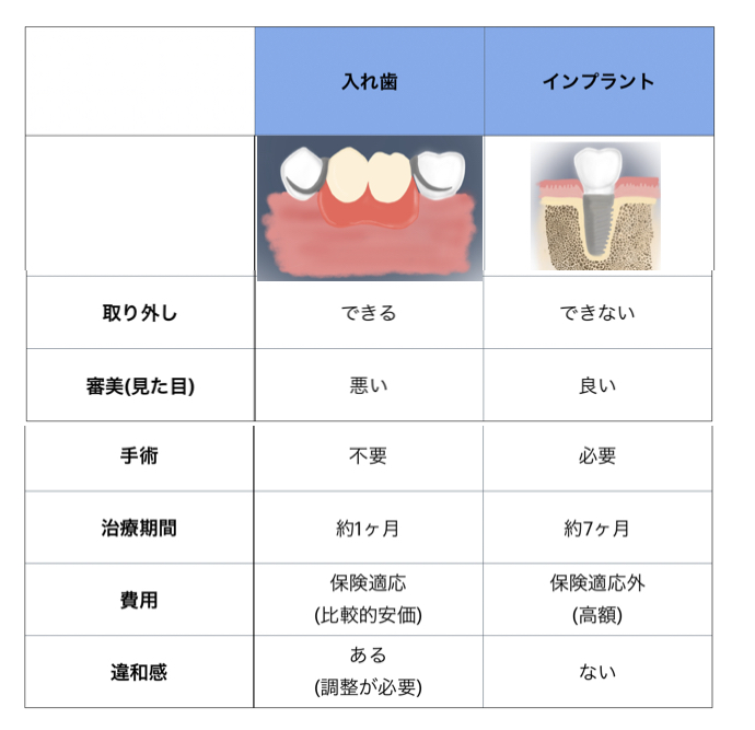 入れ歯とインプラント