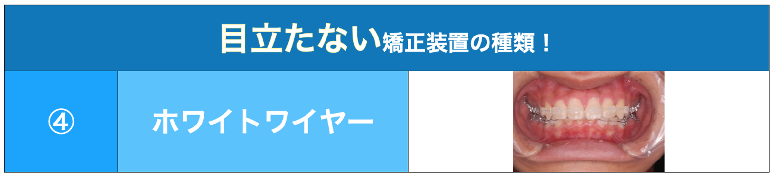 ホワイトワイヤー表