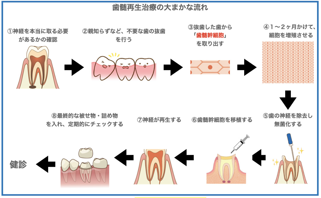 歯髄再生治療流れ