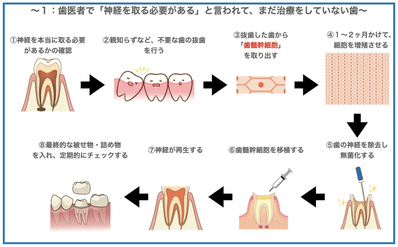 神経を蘇らせる「歯髄再生治療」のできる人・できない人を徹底解説！