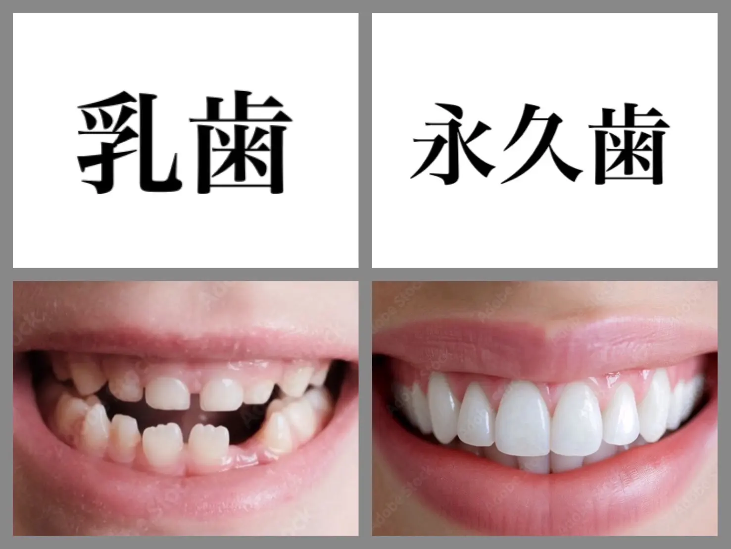 永久歯　乳歯 image2.php?1=1&w=800&c=1&r=1.